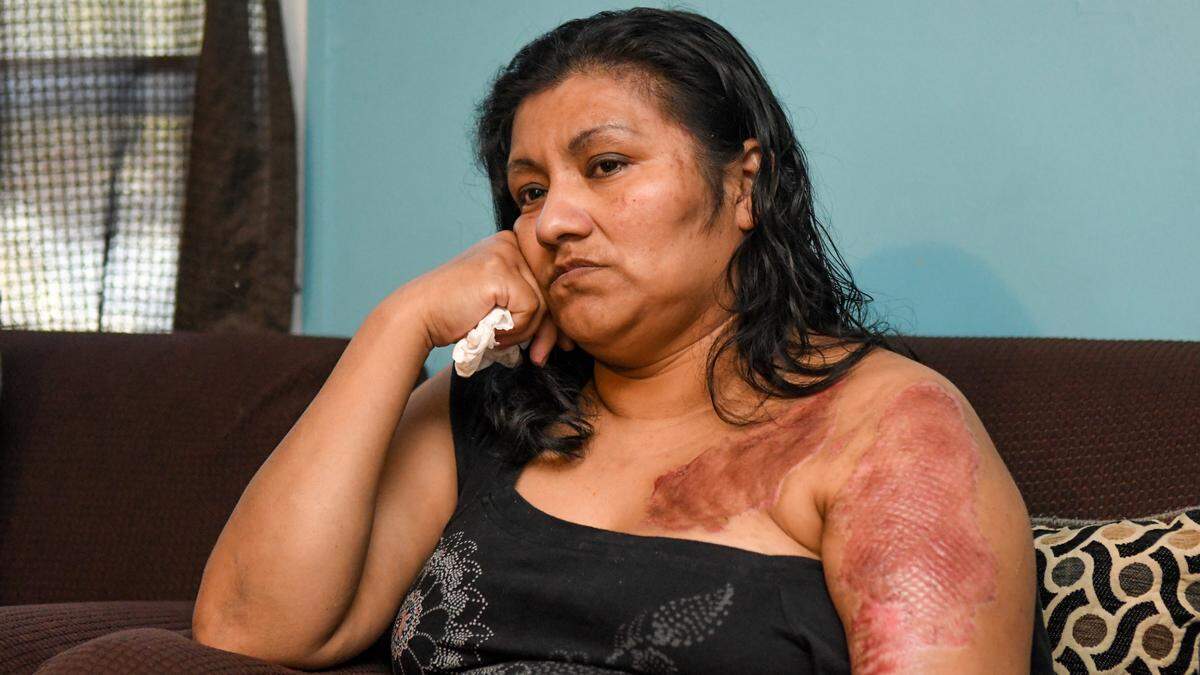 Maria Hernandez sits for an interview on Feb. 4, 2025, at her Hilton Head Island home as she recounts the evening when she was robbed by two men at knife-point and when she resisted, was punched in her left temple and sprayed with a caustic agent after leaving an ATM on Dec. 20, 2024 on the island.