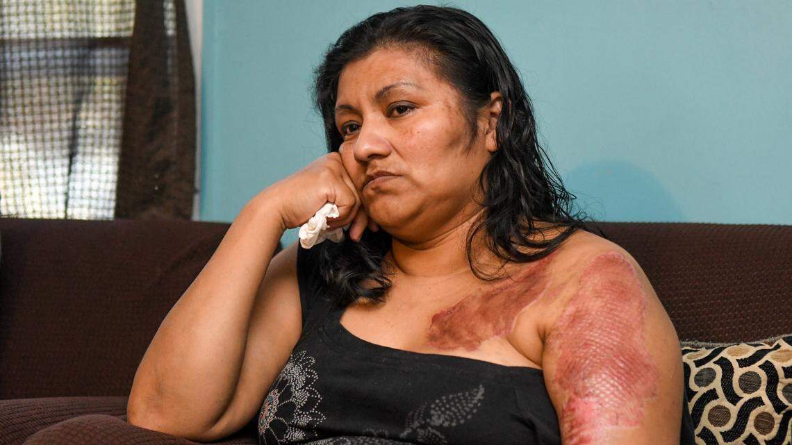 A year after Hilton Head acid attack, victim seeks answers