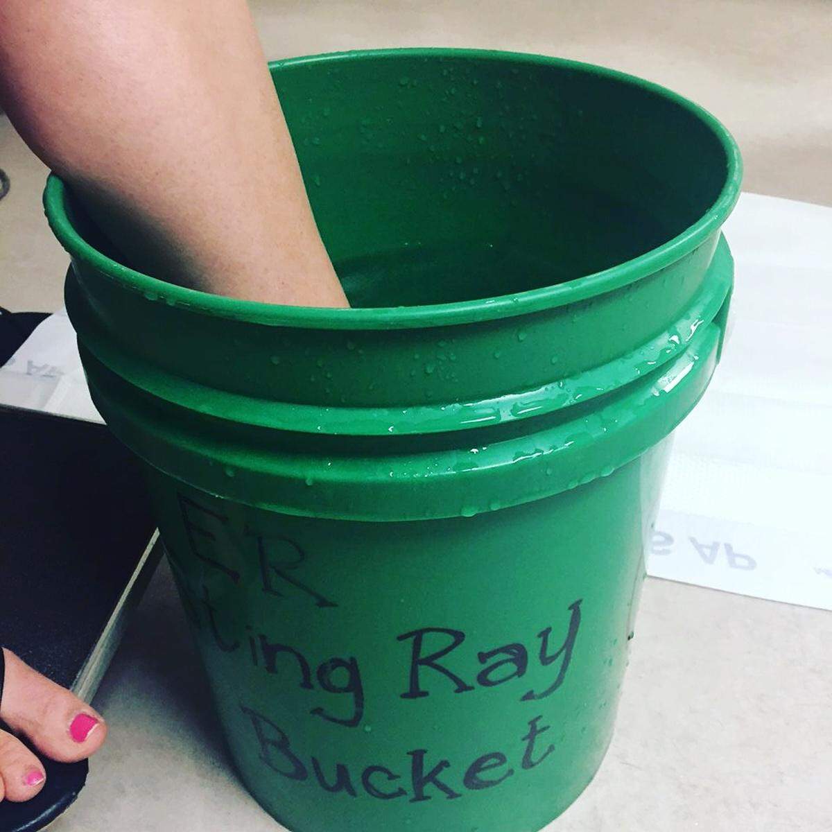 Melissa Kennelly soaks her foot in the "ER Sting Ray Bucket" at Hilton Head Hospital on Tuesday, June 12, 2018, on Hilton Head Island, S.C.