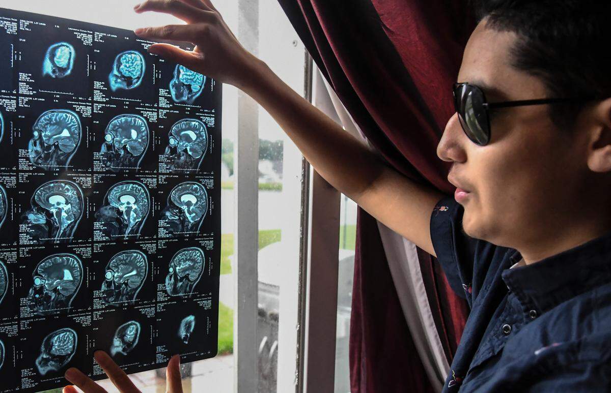 Bluffton resident Jason Garcia, 16, uses the patio door to look at his MRI on Friday morning, two weeks after the 11th grade student of May River High School had a tumor removed from the back of his head near his brain stem. Because his sensitivity to light has heightened since his surgery, Jason wears sunglasses.
