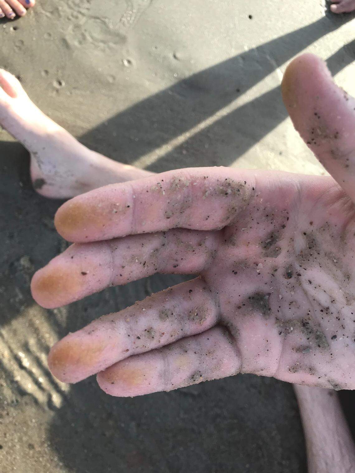 Live sand dollars produce a substance that will stain your fingers yellow.