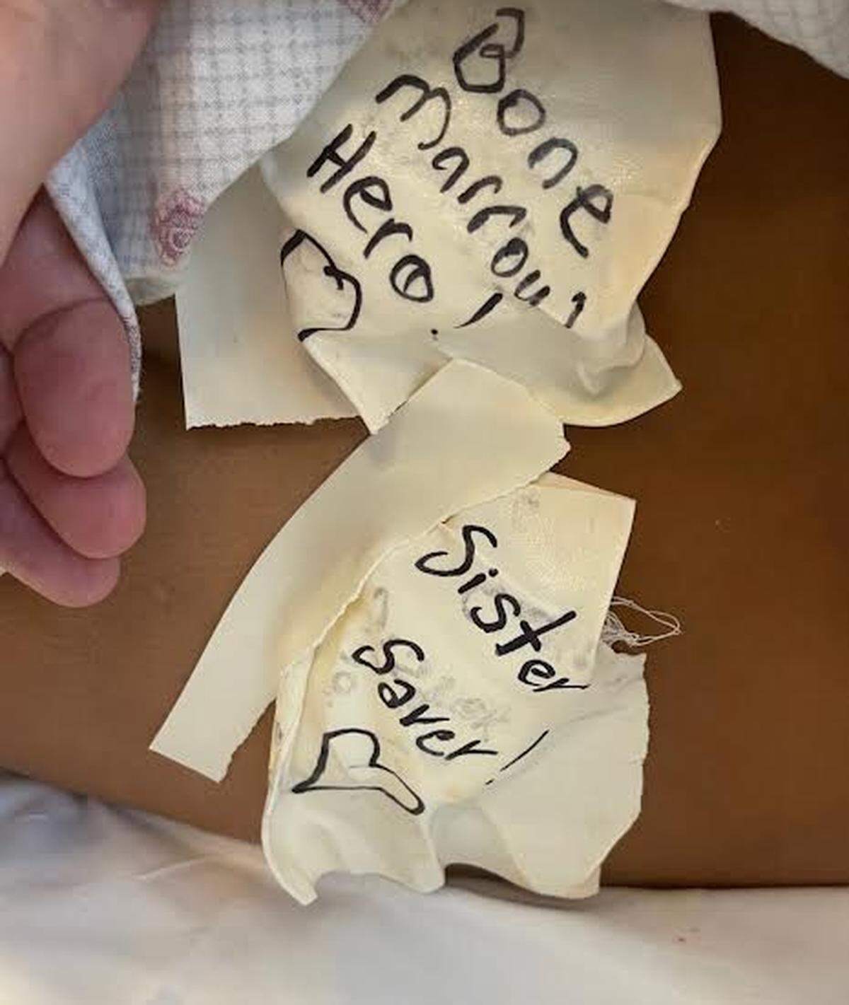 Bandages on 9-year-old Layton Busby after he underwent surgery to donate bone marrow to his 16-year-old sister Lexi.
