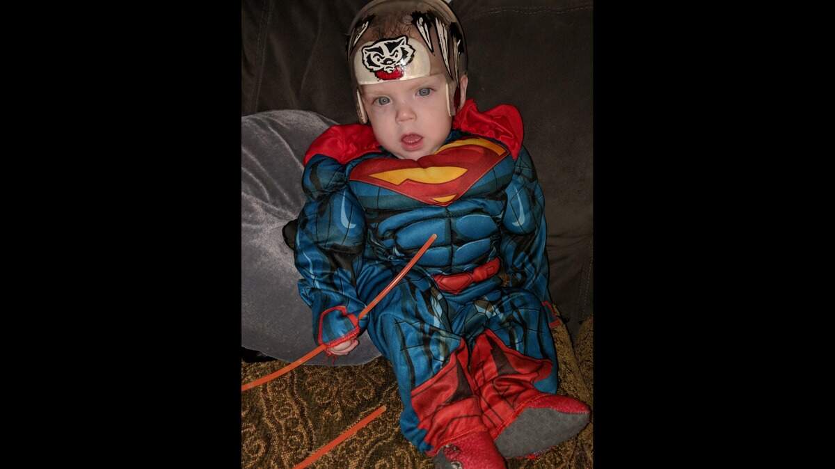 Treyton Starich poses for a photo in his Superman costume and helmet decorated by Randi Owens Arroyo after Starich’s skull surgery.