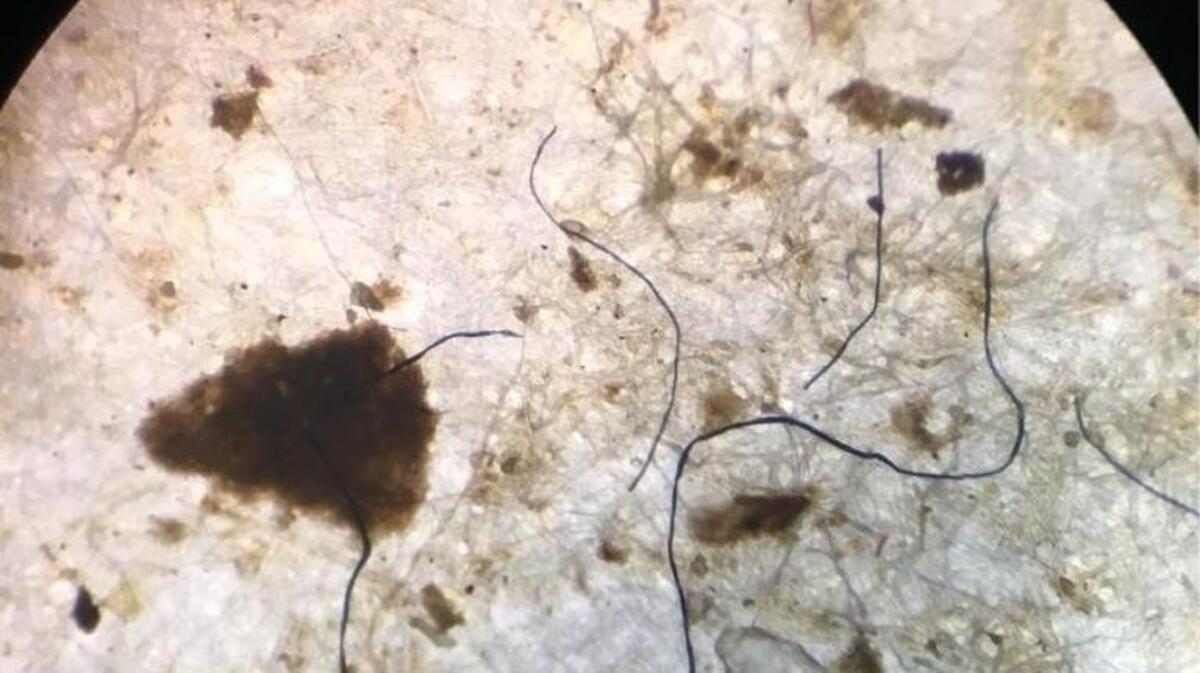 Plastics in our local oysters are the hairlike fibers in this image